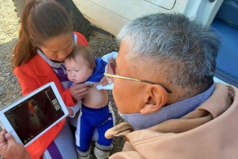 ЭМДЕГ: Зүрхний гажигтай хүүхэд бүрийн мэс засалд төрөөс 8 сая төгрөг гаргана