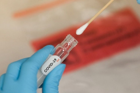 Б.Ууганбаяр: Ирэх Даваа гарагаас PCR шинжилгээний хариу гар утсанд мэссэжээр очихгүй, өөрчлөлт орно