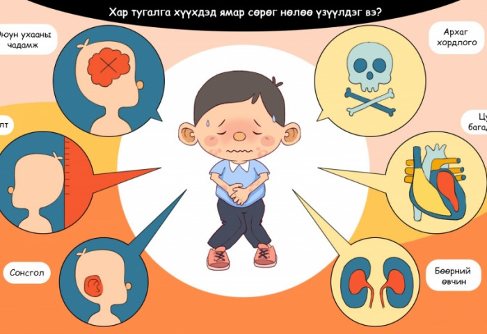 Хар тугалгын аюул хүүхдүүдийг онилжээ
