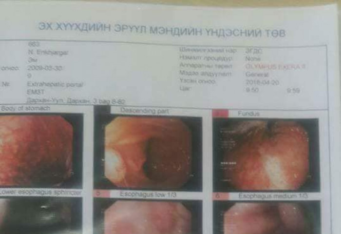 9 настай хөөрхөн охины том ирээдүй та бидний гарт байна