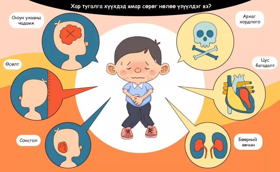 Хар тугалгын аюул хүүхдүүдийг онилжээ