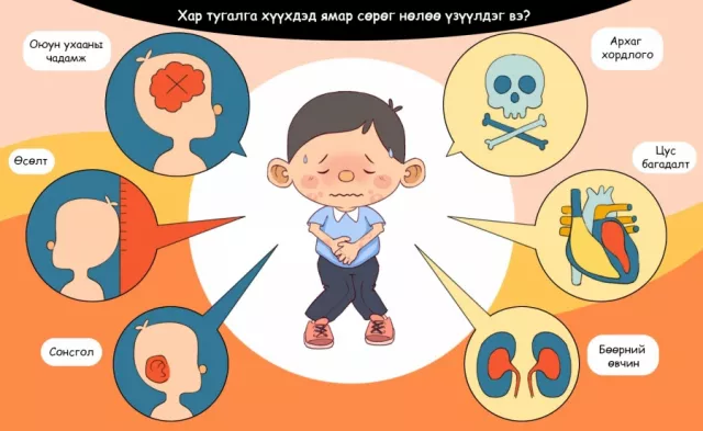 Хар тугалгын аюул хүүхдүүдийг онилжээ