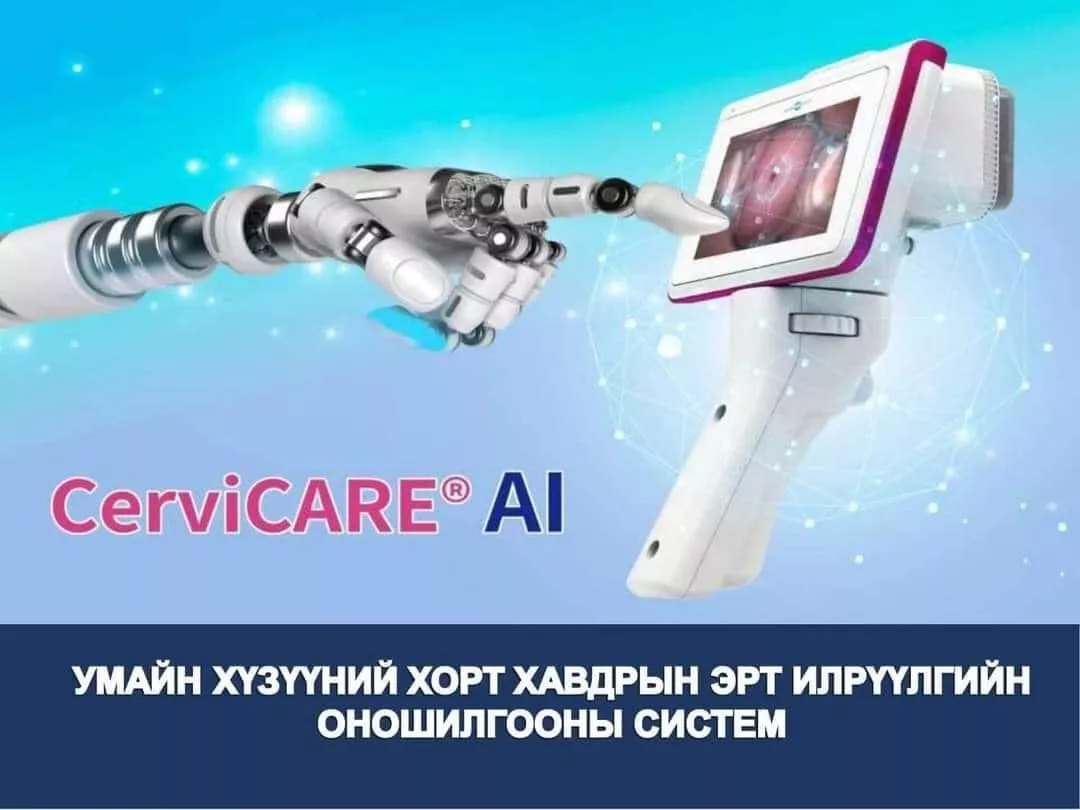 Сайн мэдээ:Хиймэл оюун ухаан ашиглаж Умай хүзүүний хорт хавдрыг цаг алдахгүй эрт илрүүлдэг болжээ