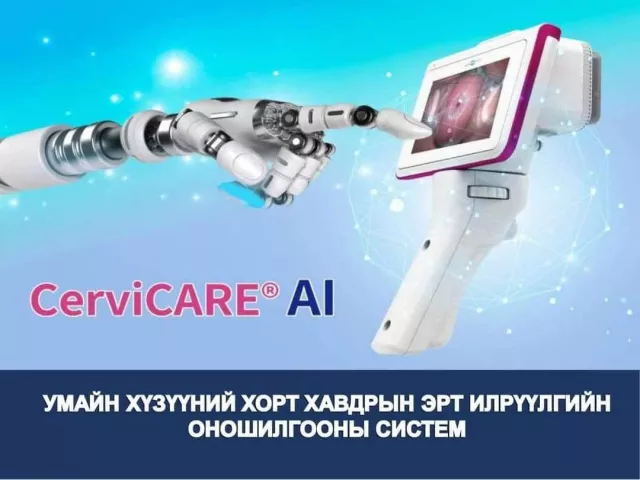 Сайн мэдээ:Хиймэл оюун ухаан ашиглаж Умай хүзүүний хорт хавдрыг цаг алдахгүй эрт илрүүлдэг болжээ